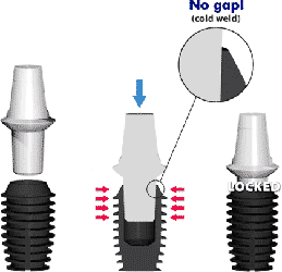 bicon_implants