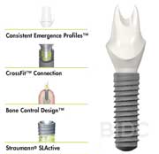 straumann-BoneLevel