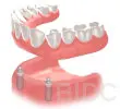 implant dentures with ball